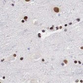 Anti-SF3A1 antibody produced in rabbit Prestige Antibodies&#174; Powered by Atlas Antibodies, affinity isolated antibody, buffered aqueous glycerol solution