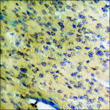 Anti-phospho-C-RAF (pSer296) antibody produced in rabbit affinity isolated antibody