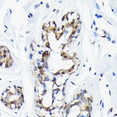 [KO Validated]Anti-SUMO1 Antibody, clone 6F8B6, Rabbit Monoclonal