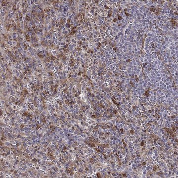 Anti-ZYX antibody produced in rabbit Prestige Antibodies® Powered by Atlas Antibodies, affinity isolated antibody, buffered aqueous glycerol solution