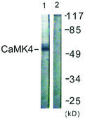 Anti-CAMK4 antibody produced in rabbit affinity isolated antibody