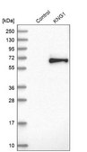 Anti-KNG1 antibody produced in rabbit Prestige Antibodies&#174; Powered by Atlas Antibodies, affinity isolated antibody, buffered aqueous glycerol solution