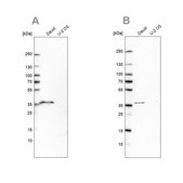Anti-MS4A1 antibody produced in rabbit Prestige Antibodies&#174; Powered by Atlas Antibodies, affinity isolated antibody, buffered aqueous glycerol solution