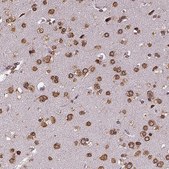 Anti-MTDH antibody produced in rabbit Prestige Antibodies&#174; Powered by Atlas Antibodies, affinity isolated antibody, buffered aqueous glycerol solution