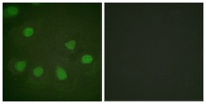 Anti-Retinoblastoma antibody produced in rabbit affinity isolated antibody