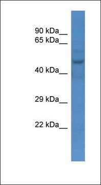 Anti-SLC16A3 antibody produced in rabbit affinity isolated antibody