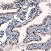 Monoclonal Anti-METTL14 antibody produced in mouse Prestige Antibodies&#174; Powered by Atlas Antibodies, clone CL4254, purified immunoglobulin