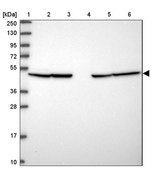 Anti-NAMPT antibody produced in rabbit Prestige Antibodies&#174; Powered by Atlas Antibodies, affinity isolated antibody, buffered aqueous glycerol solution