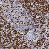 Anti-ZAP70 antibody produced in rabbit Prestige Antibodies&#174; Powered by Atlas Antibodies, affinity isolated antibody, buffered aqueous glycerol solution
