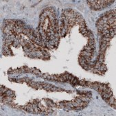 Monoclonal Anti-CS antibody produced in mouse Prestige Antibodies&#174; Powered by Atlas Antibodies, clone CL2545, purified immunoglobulin, buffered aqueous glycerol solution