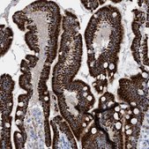 Anti-MTFR1 antibody produced in rabbit Prestige Antibodies&#174; Powered by Atlas Antibodies, affinity isolated antibody, buffered aqueous glycerol solution