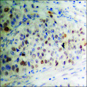 Anti-phospho-SP1 (pThr453) antibody produced in rabbit affinity isolated antibody