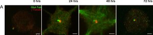 Anti-Tubulin Antibody, Detyrosinated Chemicon&#174;, from rabbit