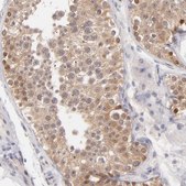 Anti-UBE2E3 antibody produced in rabbit Prestige Antibodies&#174; Powered by Atlas Antibodies, affinity isolated antibody, buffered aqueous glycerol solution