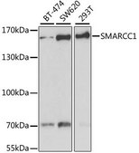 Anti-SMARCC1 antibody produced in rabbit