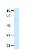 Anti-XK (ab2) antibody produced in rabbit affinity isolated antibody