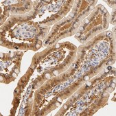 Anti-CA2 antibody produced in rabbit Prestige Antibodies&#174; Powered by Atlas Antibodies, affinity isolated antibody, buffered aqueous glycerol solution