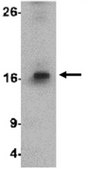 Anti-SDHD Antibody from rabbit, purified by affinity chromatography