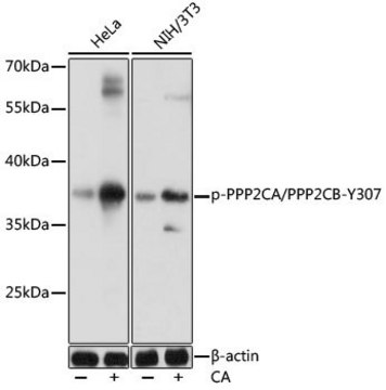 Anti-Phospho-PPP2CA/PPP2CB-Y307 antibody produced in rabbit