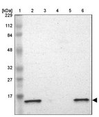 Anti-ATP5D antibody produced in rabbit Prestige Antibodies&#174; Powered by Atlas Antibodies, affinity isolated antibody, buffered aqueous glycerol solution