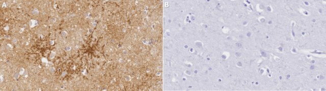 Anti-Aquaporin 4 Antibody Chemicon&#174;, from rabbit
