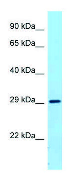 Anti-FCGR2B (C-terminal) antibody produced in rabbit affinity isolated antibody