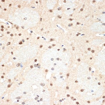 Anti-PSMA2 antibody produced in rabbit
