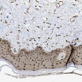 Anti-PSMC5 antibody produced in rabbit Prestige Antibodies&#174; Powered by Atlas Antibodies, affinity isolated antibody, buffered aqueous glycerol solution