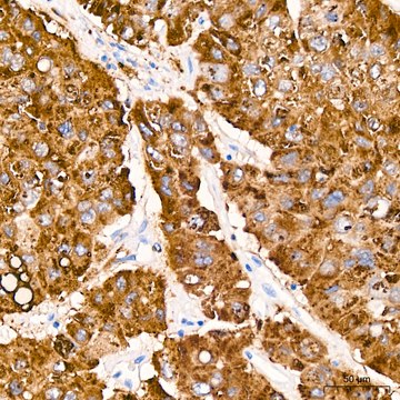 Anti-Cathepsin L/V/K/H Antibody, clone 2Q10F10, Rabbit Monoclonal