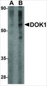 Anti-DOK1 antibody produced in rabbit affinity isolated antibody, buffered aqueous solution