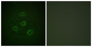 Anti-PP2A-&#945; antibody produced in rabbit affinity isolated antibody