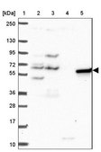 Anti-PAK3 antibody produced in rabbit Prestige Antibodies&#174; Powered by Atlas Antibodies, affinity isolated antibody, buffered aqueous glycerol solution