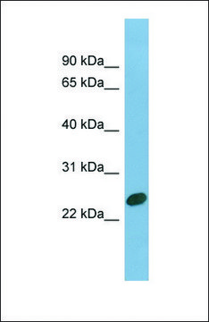 Anti-CHMP1B, (N-terminal) antibody produced in rabbit affinity isolated antibody