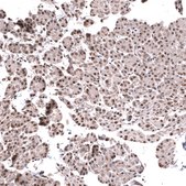 Monoclonal Anti-Foxo3 Antibody Produced In Mouse Prestige Antibodies&#174; Powered by Atlas Antibodies, clone CL13603, affinity isolated antibody, buffered aqueous glycerol solution