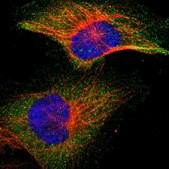 Anti-IKBKB antibody produced in rabbit Prestige Antibodies® Powered by Atlas Antibodies, affinity isolated antibody, buffered aqueous glycerol solution