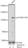 Anti-Phospho-PTK2B-Y402 antibody produced in rabbit