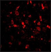 Anti-TSLP (ab3) antibody produced in rabbit affinity isolated antibody