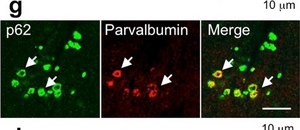 Anti-Parvalbumin Antibody ascites fluid, clone PARV-19, Chemicon&#174;