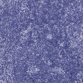 Anti-PDYN antibody produced in rabbit Prestige Antibodies® Powered by Atlas Antibodies, affinity isolated antibody, buffered aqueous glycerol solution