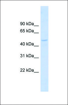 Anti-DBNL antibody produced in rabbit affinity isolated antibody