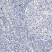 Anti-DNAH5 antibody produced in rabbit Prestige Antibodies&#174; Powered by Atlas Antibodies, affinity isolated antibody, buffered aqueous glycerol solution
