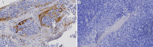 Anti-S1PR2 Antibody, clone 1C18 ZooMAb&#174; Rabbit Monoclonal recombinant, expressed in HEK 293 cells