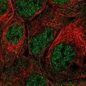 Anti-PRMT2 antibody produced in rabbit Prestige Antibodies&#174; Powered by Atlas Antibodies, affinity isolated antibody, buffered aqueous glycerol solution