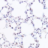 Anti- BRG1/SMARCA4 antibody produced in rabbit