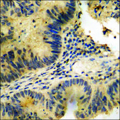 Anti-phospho-p53 (pThr387) antibody produced in rabbit affinity isolated antibody