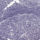 Anti-OXT antibody produced in rabbit Prestige Antibodies&#174; Powered by Atlas Antibodies, affinity isolated antibody