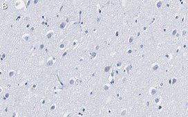 Anti-CaM Kinase IIα Antibody, clone 1C20 ZooMAb® Rabbit Monoclonal recombinant, expressed in HEK 293 cells