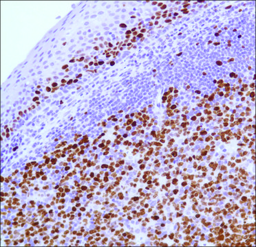 Anti-KI-67 antibody, Rabbit monoclonal clone SP6, recombinant, expressed in proprietary host, tissue culture supernatant