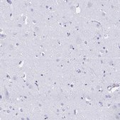 Anti-RUNX3 antibody produced in rabbit Prestige Antibodies&#174; Powered by Atlas Antibodies, affinity isolated antibody, buffered aqueous glycerol solution