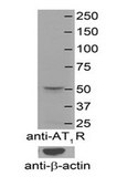 Anti-AGTR1 antibody produced in rabbit affinity isolated antibody